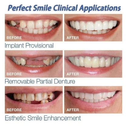 SnapWhite Smile Kit