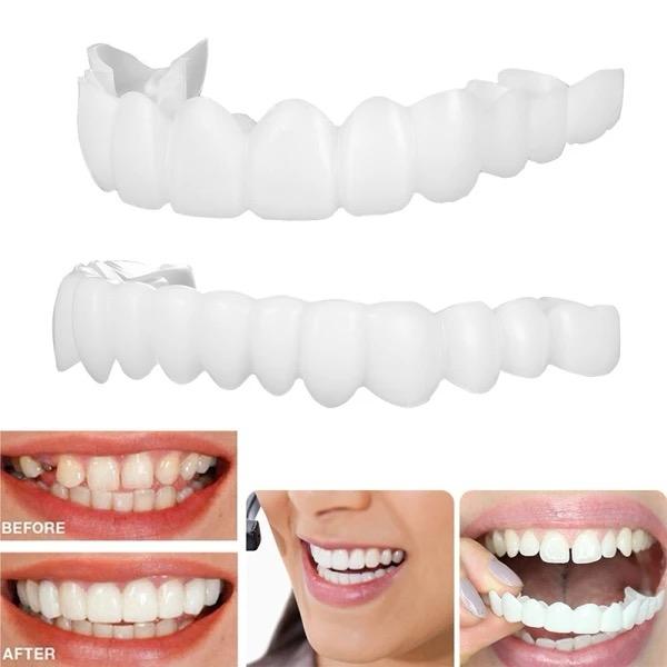 SnapWhite Smile Kit