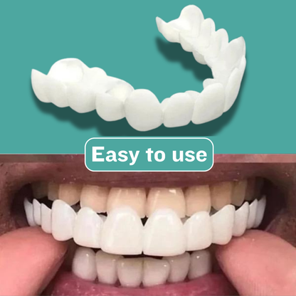 SnapWhite Smile Kit